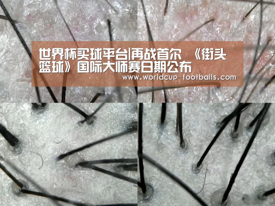 世界杯买球平台|再战首尔 《街头篮球》国际大师赛日期公布(图3) 世界杯买球